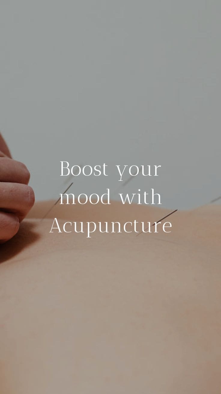 acupuncture for mental health
