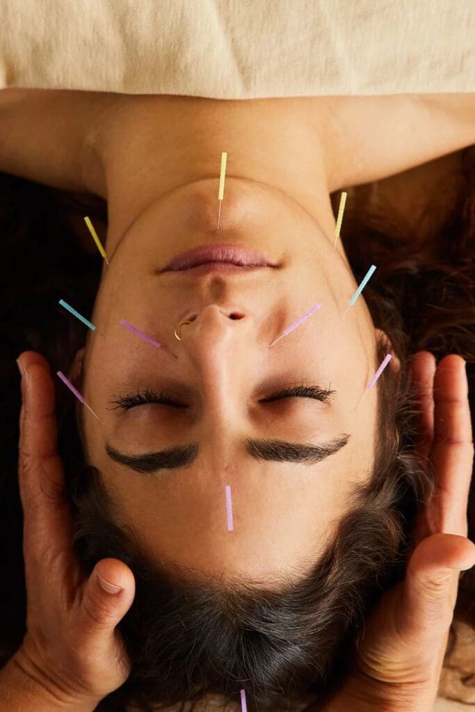 acupuncture for seasonal allergy in McLean