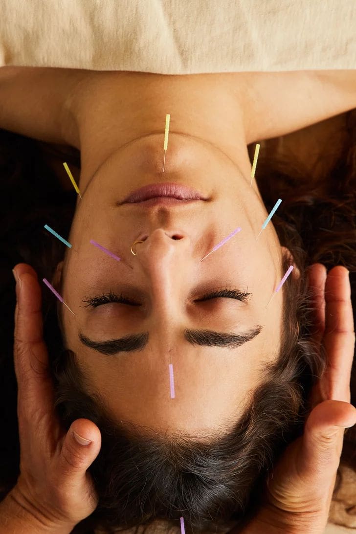 acupuncture for seasonal allergy in McLean