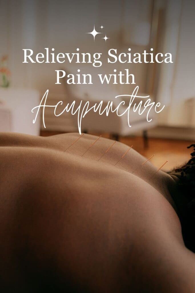 acupuncture for sciatica pain